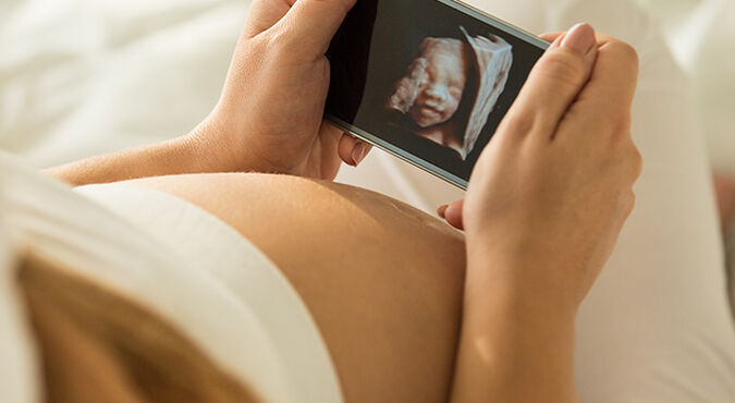 Ultra-som gravidez 3D