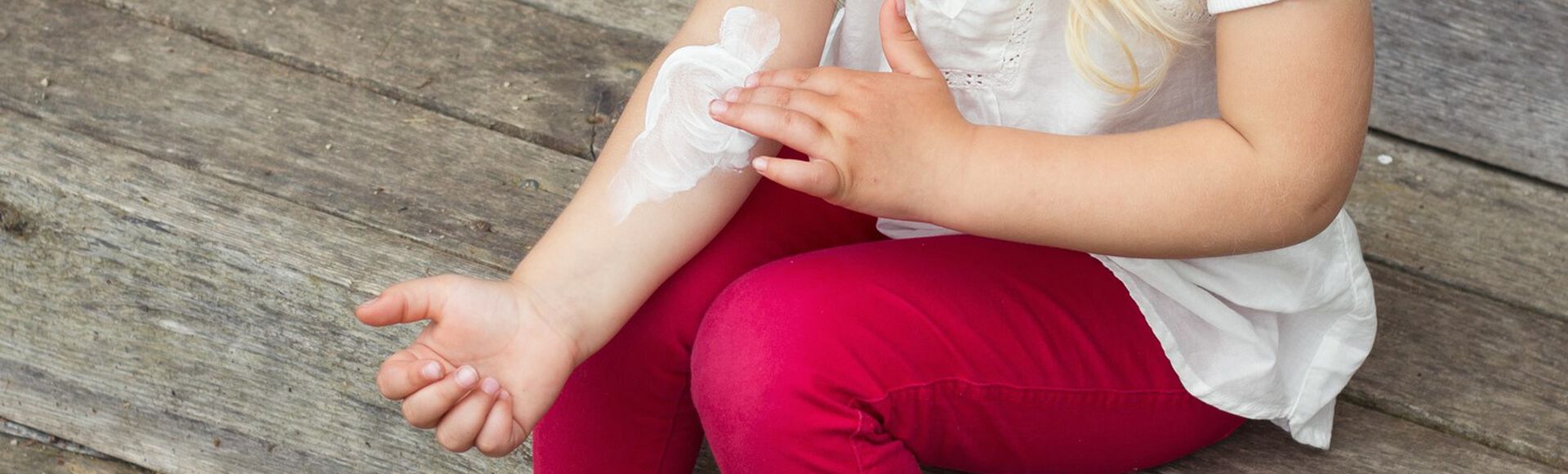 Pézinho de bebê com erupção cutânea vermelha  sintoma comum da dermatite atópica infantil