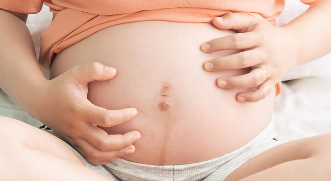Tudo sobre colestase na gravidez