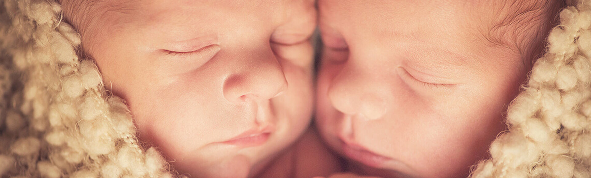 O que é Síndrome Tranfusão Feto-Fetal