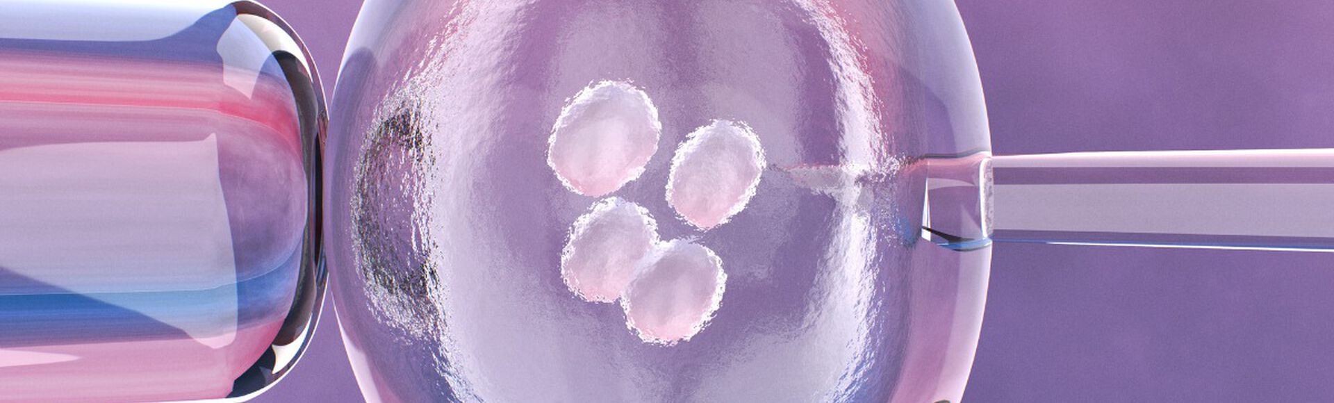Ilustração de procedimento de fertilização in vitro
