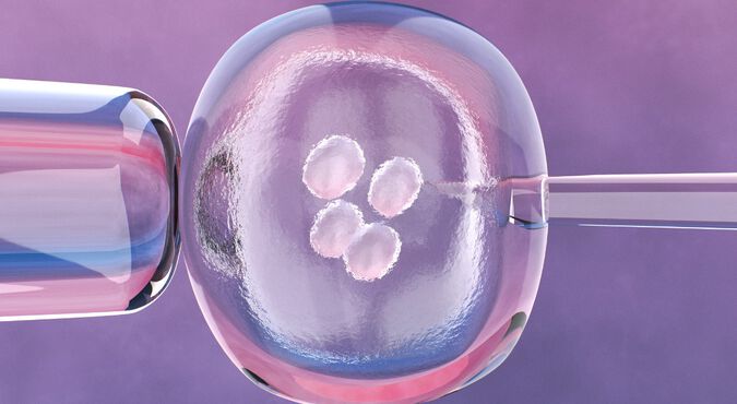 Ilustração de procedimento de fertilização in vitro