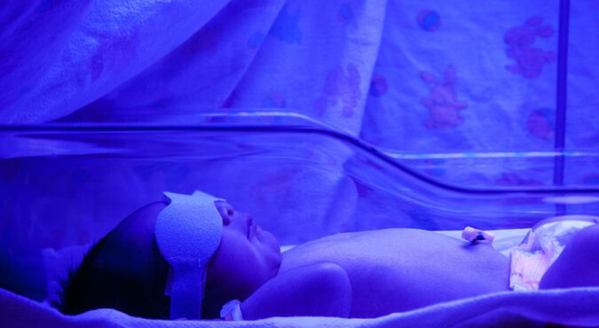 Bebe recem-nascido com tapa-olho recebendo fototerapia de luz azul