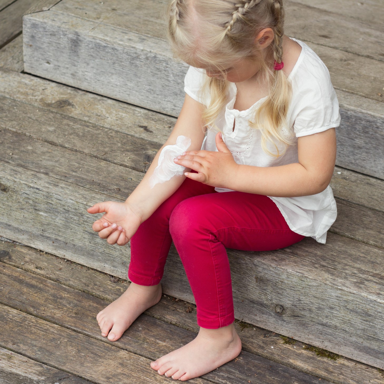 A dermatite atópica infantil, muitas vezes chamada de eczema, é uma condição de pele muito comum em crianças. Veja causas e tratamentos.